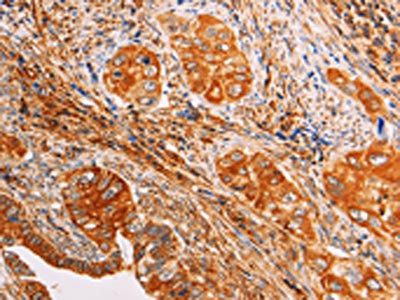 SLC25A4 Antibody