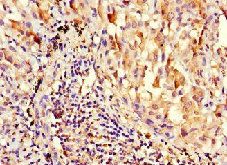 SLC25A5 Antibody