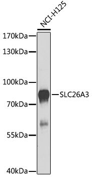 SLC26A3 antibody
