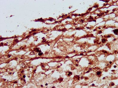 SLC26A4 Antibody