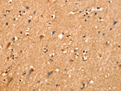 SLC26A4 Antibody