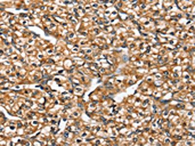 SLC26A5 Antibody