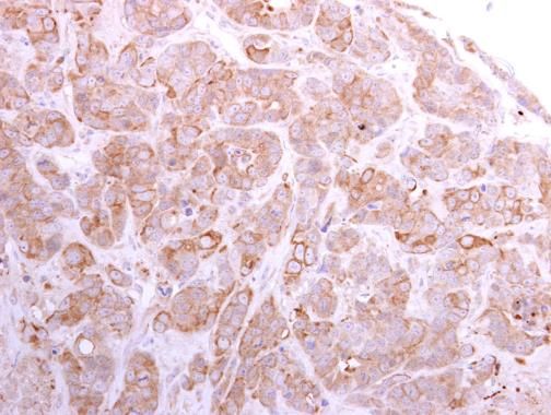 SLC26A8 Rabbit Polyclonal Antibody
