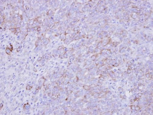 SLC26A8 Rabbit Polyclonal Antibody