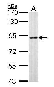 SLC26A8 Rabbit Polyclonal Antibody