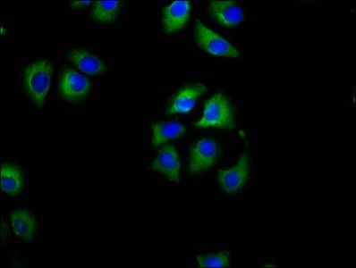 SLC27A1 antibody