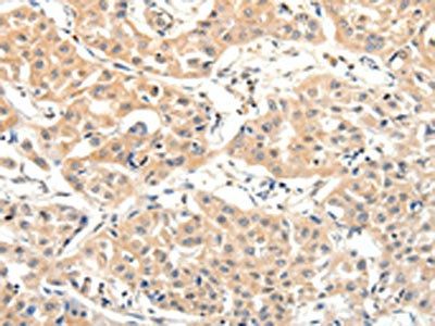 SLC27A1 Antibody