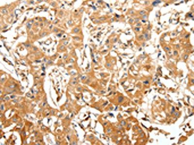 SLC27A1 Antibody