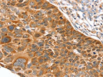 SLC27A2 Antibody