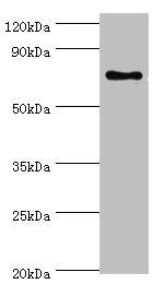 SLC27A6 antibody