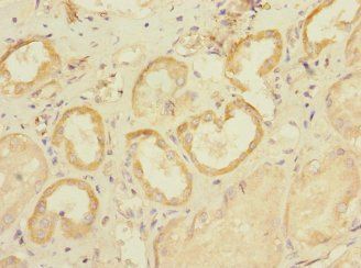 SLC28A1 Antibody