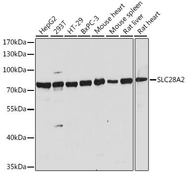 SLC28A2 antibody