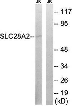 SLC28A2 antibody