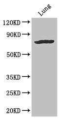 SLC28A3 Antibody