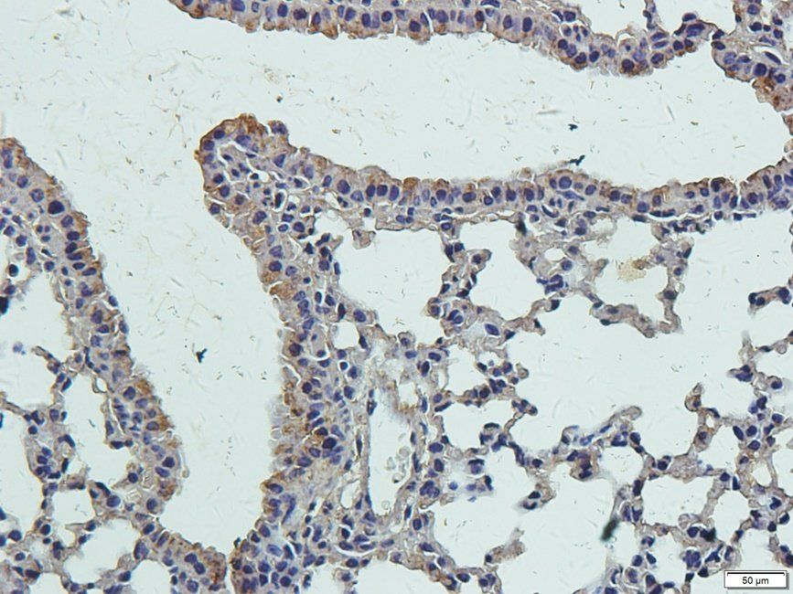 Slc28a3 Rabbit Polyclonal Antibody