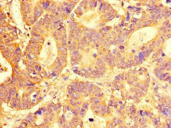 SLC29A1 Antibody