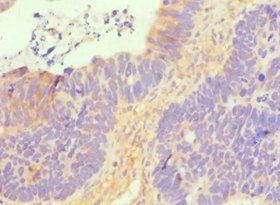 SLC2A1 Antibody