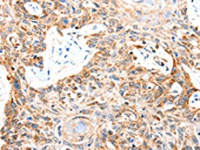SLC2A1 Antibody