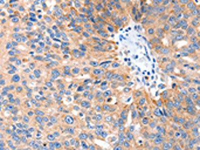 SLC2A1 Antibody