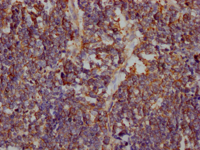 SLC2A1 Recombinant Monoclonal Antibody