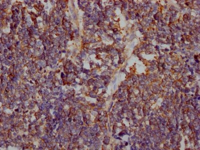 SLC2A1 antibody