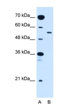 SLC2A10 antibody