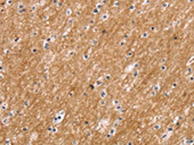 SLC2A3 Antibody
