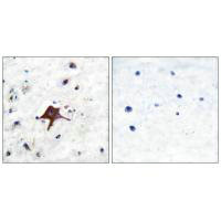 SLC2A3 Antibody