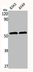 SLC2A4 Antibody