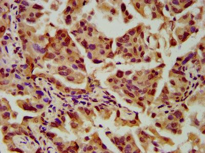 SLC2A4RG Antibody
