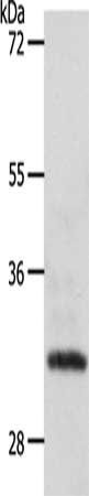 SLC2A4RG Antibody