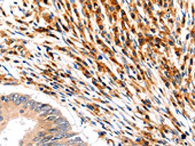 SLC2A5 Antibody