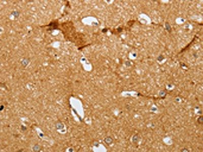 SLC2A5 Antibody