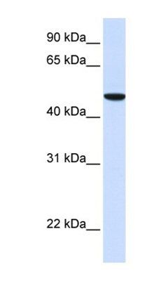 SLC2A6 antibody