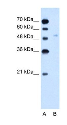 SLC2A6 antibody
