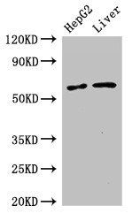 SLC2A9 antibody