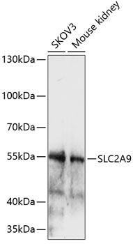 SLC2A9 antibody