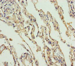 SLC34A1 Antibody