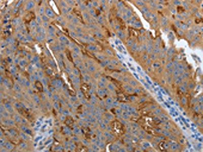 SLC34A2 antibody