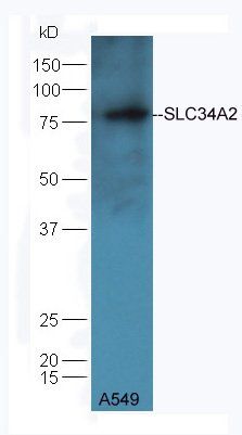 SLC34A2 Rabbit Polyclonal Antibody