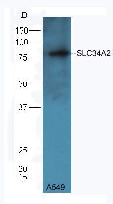 SLC34A2 antibody