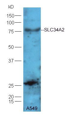 SLC34A2 Rabbit Polyclonal Antibody