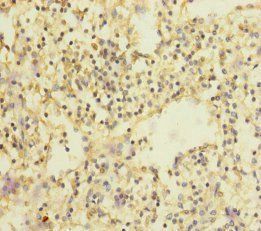 SLC35A1 Antibody