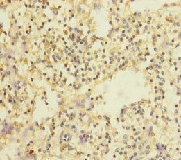 SLC35A1 antibody