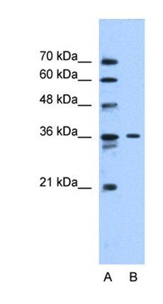 SLC35A3 antibody