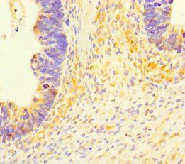 SLC35D2 antibody