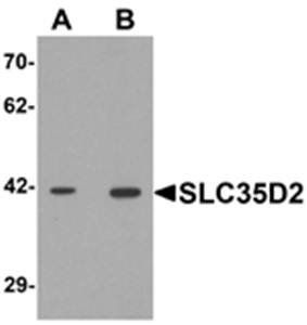 SLC35D2 Antibody