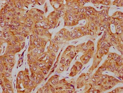 SLC35D3 Antibody