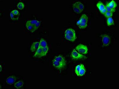 SLC35F6 Antibody