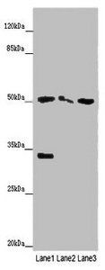 SLC38A6 antibody
